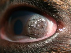 Dermoid